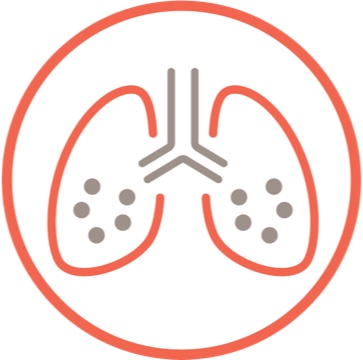 Creșterea gradului de fibroză pe HRCT