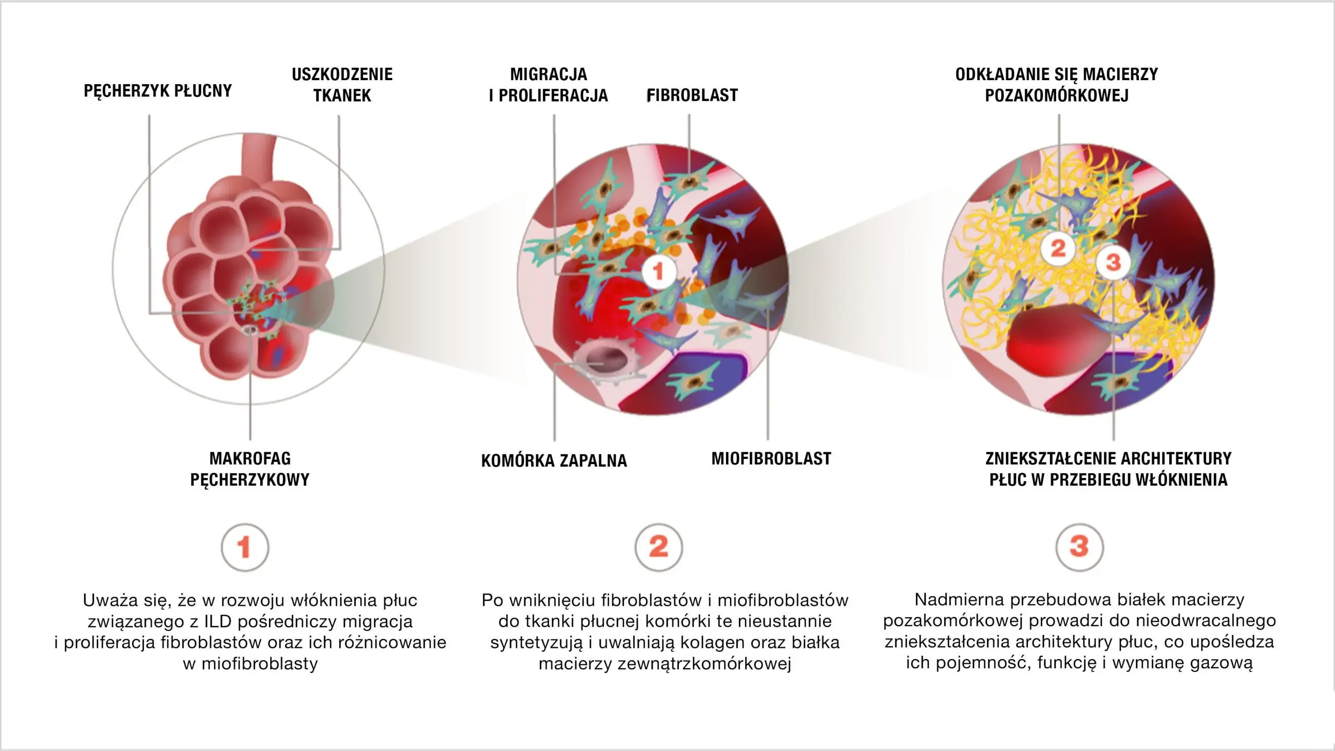 căi patogene comune