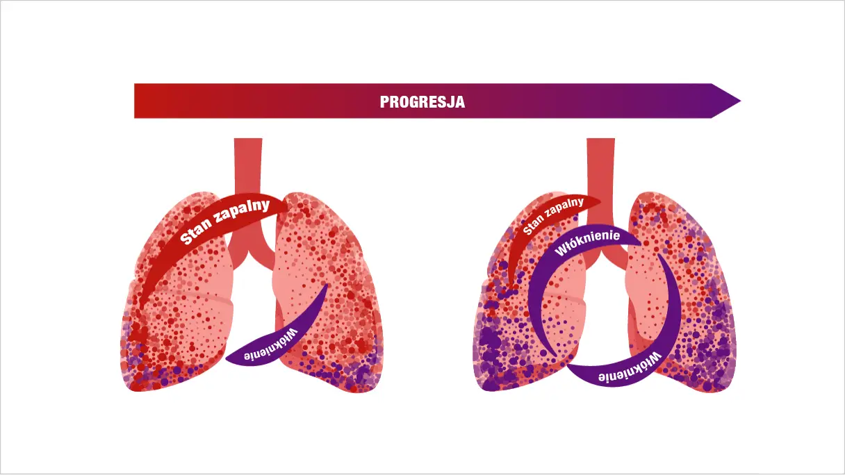 Progresia fibrozei care se autosusține