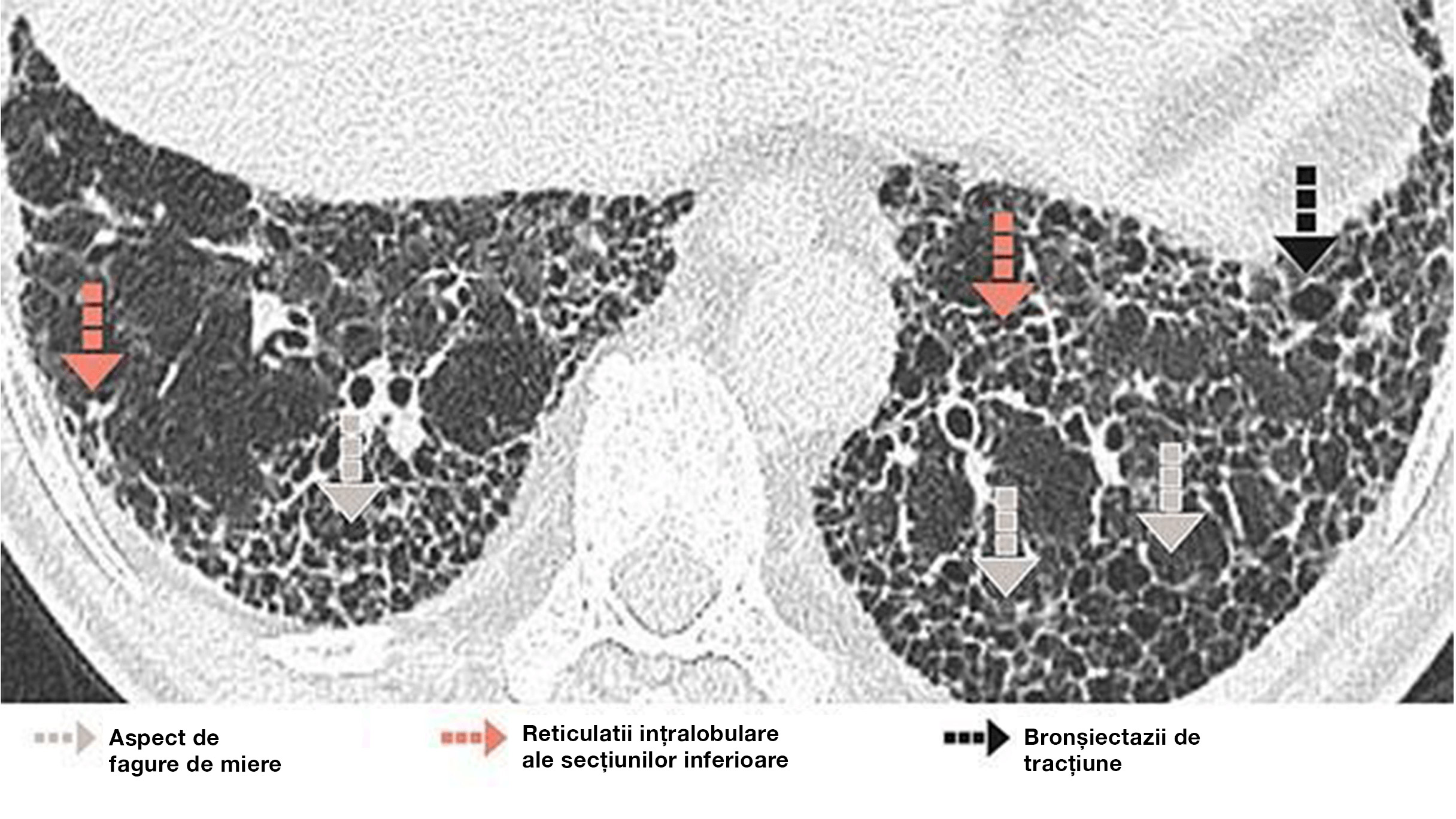 ASPECT DE FAGURE DE MIERE