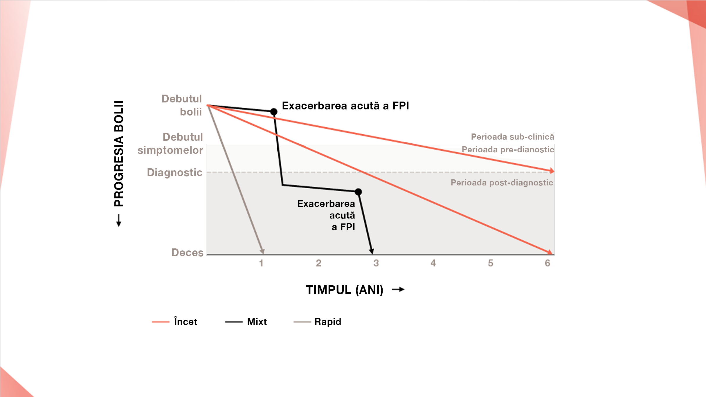 Supraviețuirea scade în urma unei exacerbări acute a Fibrozei pulmonare