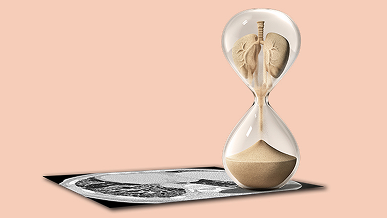 Descoperiți pacienții cu PID